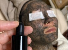 エミナス(EMINAS)/肌変化率No.1★ハーブ