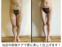 スリーピングビューティー(Sleeping Beauty)の雰囲気（ダイエット/術後ケア/シミしわたるみ/リフトUP等はお任せ下さい!）