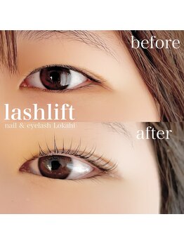 ロカヒ(Lokahi)/＊まつげパーマ（ラッシュリフト