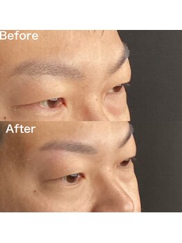 眉毛ハウス 吉祥寺店(眉毛HOUSE)/お客様の施術例(吉祥寺/東京)