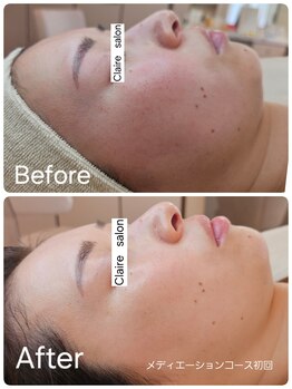 クレイルサロン(Claire salon)/ソフトハーブコース