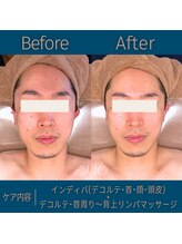 スー(Sue)/フェイシャルbefore→after