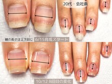 エヌプラス(Nplus)/美爪育成３ヵ月コース