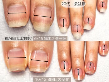 エヌプラス(Nplus)/美爪育成３ヵ月コース