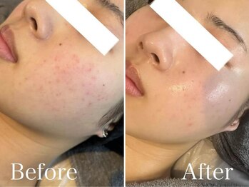 エープラス(A+)/アンストレス