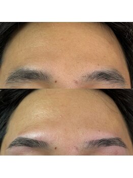 アレス 錦糸町店(Ares)/メンズ眉毛専門店Ares眉サロン