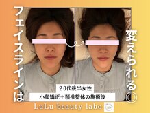ルルラボ(LuLu beauty labo)/即実感！輪郭スッキリ小顔