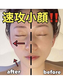 リズベット(LIZ BET)/韓国式小顔コルギで速攻小顔！