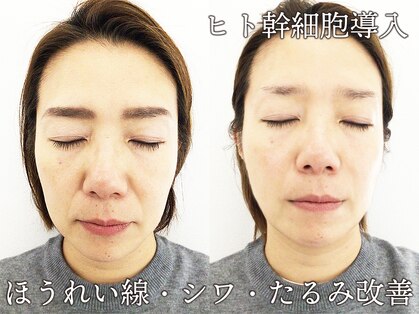 ヴァカンス 池袋店(VACANCES)の写真