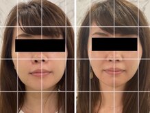 ムーン(Moon)の雰囲気（SNSで話題《電流ヘッドスパ》で小顔リフトアップ★自律神経整う）