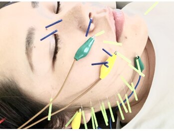 アイズ鍼灸院(I's鍼灸院)/美容鍼