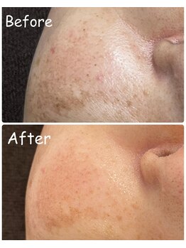 ギャラクシービューティー(galaxy beauty)/