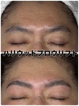 ルマエクレ(rmaecla)/ハリウッドブロウリフト 眉毛