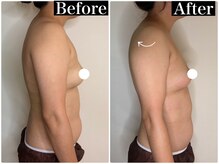 ハーズプラス(hers+)/デコルテの削げ、垂れ乳が綺麗に