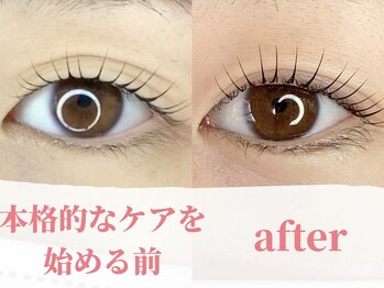エースラッシュエヌ(A/N)/ケア前後のまつげパーマの変化!