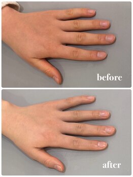 オテテ アイアンドハンド(otete eye&hand)/ハンドケアビフォーアフター