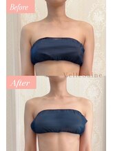 ヴェルセーヌ(VelleSaine)/2ヶ月前からスタート/ブライダル