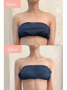 ヴェルセーヌ(VelleSaine)/2ヶ月前からスタート/ブライダル