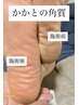 かかとの角質とりコース