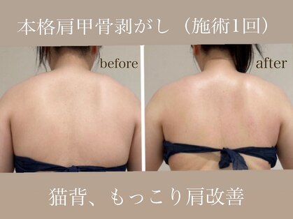 ハクカスパ(HAKUKA SPA)の写真