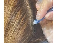 ココ センガ ビューティー クリニック(COCO SENGA Beauty-Clinic)/ジェットピール　ヘア