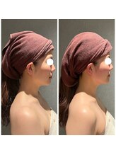 ギンザクリア 銀座本店(GINZA CLEAR)/リフトアップ超音波＋小顔コルギ