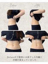 シェリー(Cherie)/腰痛にも効果的