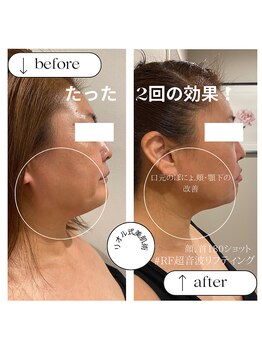 リオル(Rior)/40代以降の方に◎