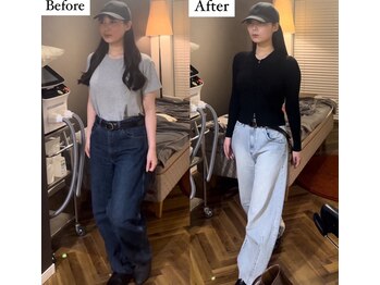 コルミチョン サロン(骨美整 salon)/歩き方　Before・After