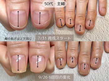 エヌプラス(Nplus)/美爪育成３ヵ月コース