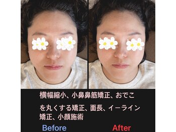 美容矯正サロン レレポノ(LELEPONO)/