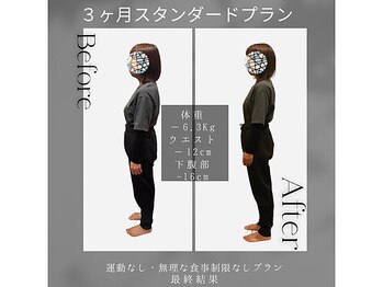 ソフィアパレス 西葛西店/DNAダイエットの結果ケースNo2