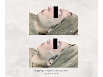 エスポワールカルド(Espoir caldo)/