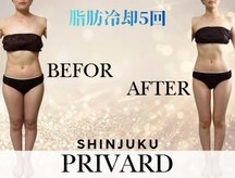 プリバード 新宿店