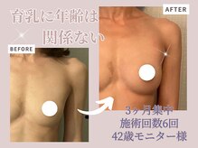 プレフィール(PLEAFEEL)の雰囲気（３ヶ月集中理想のバストへ育ち♪美胸を目指せます♪）