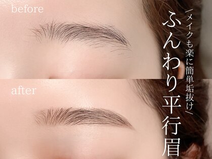 ミュー(mieux)の写真