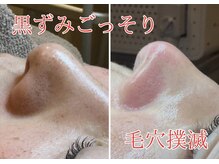 ジュエルオーキッド(Jewel orchids)