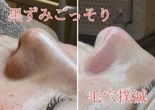ジュエルオーキッド(Jewel orchids)