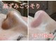 ジュエルオーキッド(Jewel orchids)の写真