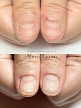 マリーロール 梅田店(Marie Laure)/自爪育成/深爪矯正/ネイルケア