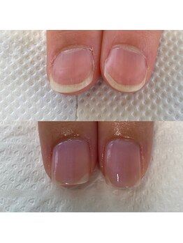 最強のネイルケアでテンションUP