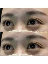 レビー(Revie)/フラットマット 100本