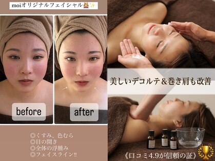 モア(Moi)の写真