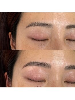 アイアム 大阪梅田 中崎町店(I am.)/HBL(ハリウッドブロウリフト)