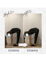 ラクリエ 東加古川院(La Creer)/お客様ビフォーアフター