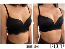 フーアップ 北千住(FU-UP)/バストアップ/育乳（1回）
