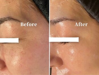 エープラス(A+)/シャトーデボーテ