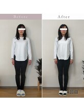 エスプリクレール(Esprit Clair)/【札幌/西28丁目】美容整体40分