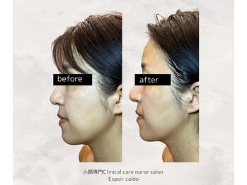 エスポワールカルド(Espoir caldo)/