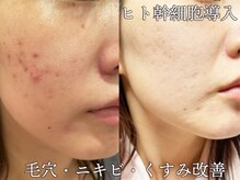 ヴァカンス 池袋店(VACANCES)